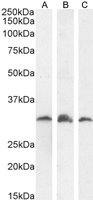 PI31/PSMF1 (Isoform 1) Antibody