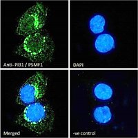PI31/PSMF1 (Isoform 1) Antibody