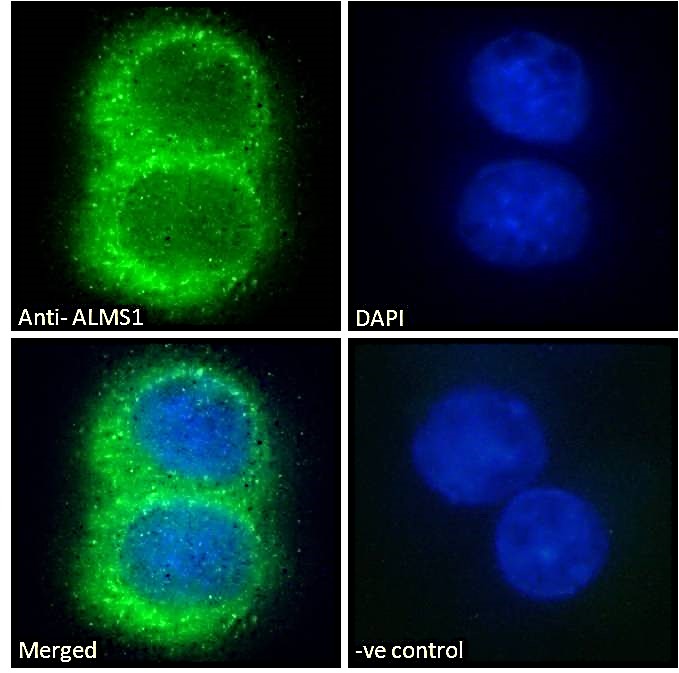 ALMS1 Antibody