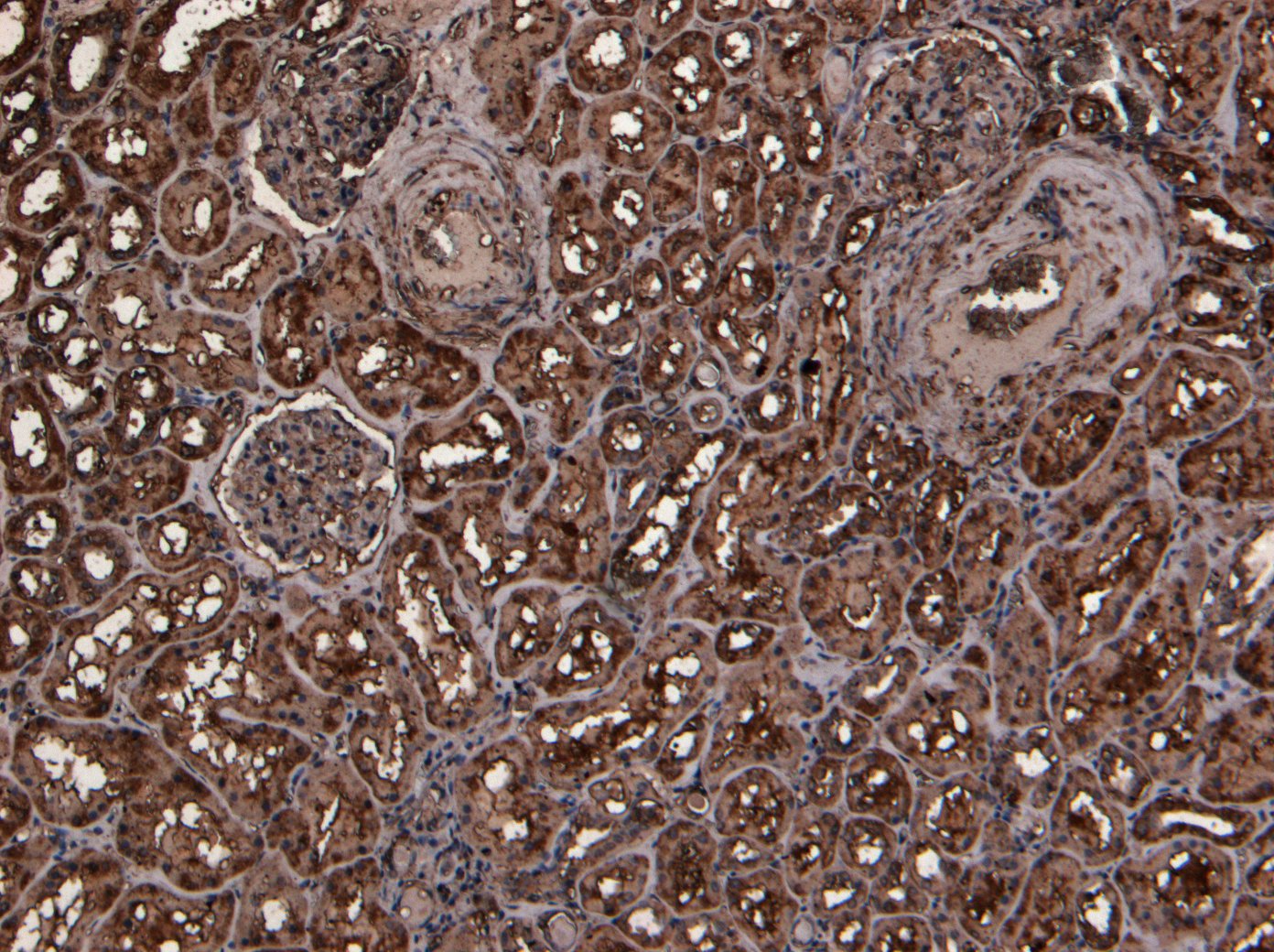 Goat anti-TMPRSS2 Antibody