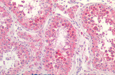 Calnexin Antibody