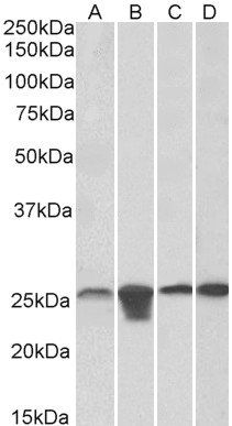 MNSOD (aa119-130) Antibody