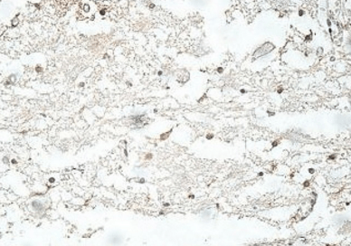 ASRGL1 Antibody