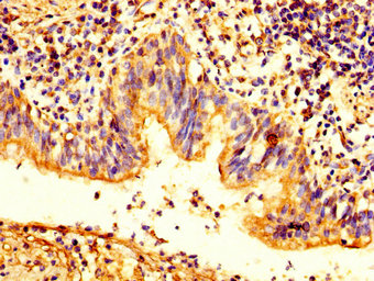 PKP2 Antibody (Biotin)