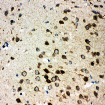 Integrin alpha 3/ITGA3 Rabbit Polyclonal Antibody