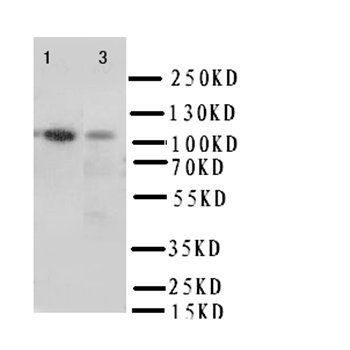 Integrin alpha 3/ITGA3 Rabbit Polyclonal Antibody