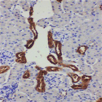 Kallikrein 1/KLK1 Rabbit Polyclonal Antibody