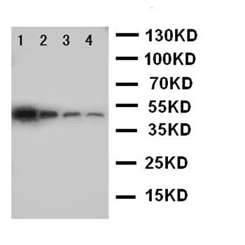 MCK10/DDR1 Rabbit Polyclonal Antibody