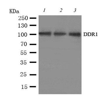 MCK10/DDR1 Rabbit Polyclonal Antibody