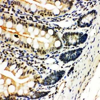 NFkB/NFKB2 p100/p52 Rabbit Polyclonal Antibody