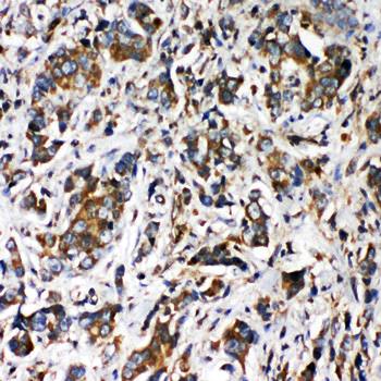 VRL1/TRPV2 Rabbit Polyclonal Antibody