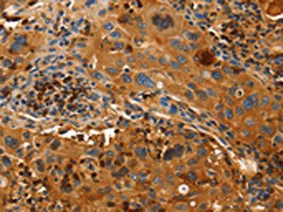 ORM2 Antibody