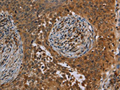 OSM Antibody