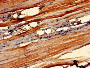 OSMR Antibody