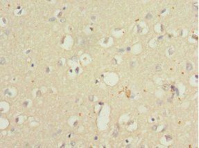 QKI Antibody