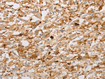 S100A1 Antibody