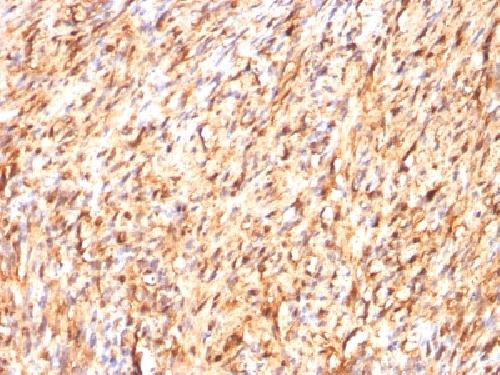 S100B Antibody