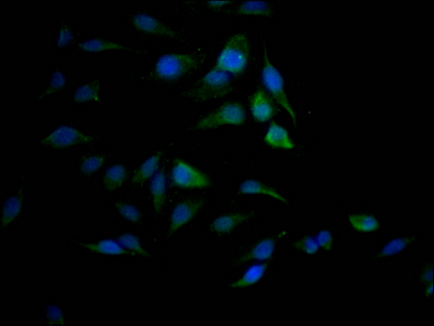 SAE1 Antibody
