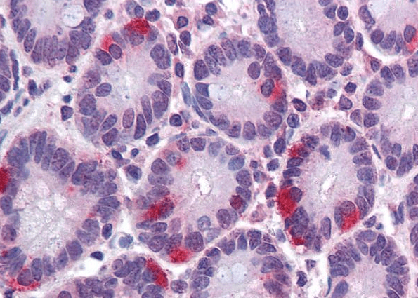 SAR1 Antibody