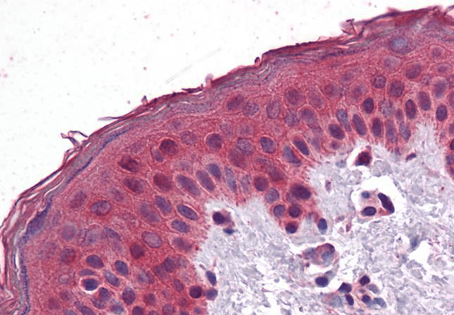 SAR1 Antibody