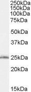 SAR1B/SARA2 Antibody