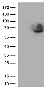 SARS-CoV-2 N Protein Rabbit Monoclonal Antibody