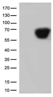 SARS-CoV-2 N Protein Rabbit Monoclonal Antibody