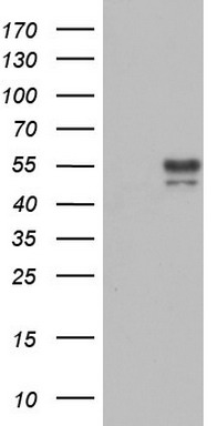 SARS-CoV-2 N Protein Rabbit Monoclonal Antibody