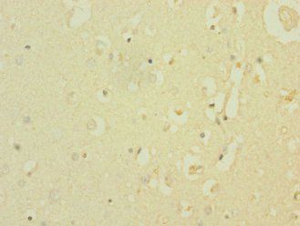 SCN8A Antibody