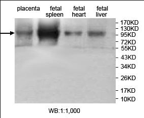 JHDM1D Antibody