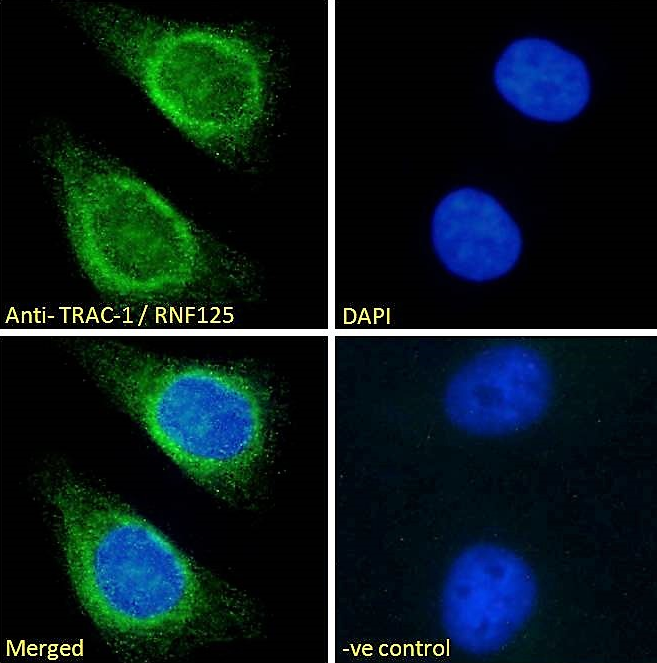 TRAC-1/RNF125 Antibody
