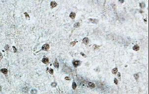 JHDM1D Antibody