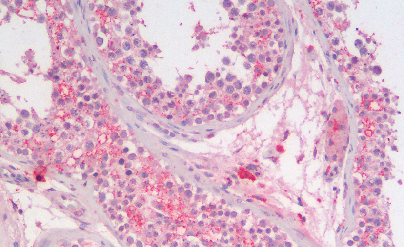 Sgta (mouse aa84-97) Antibody