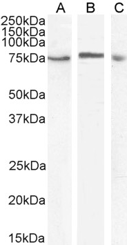TAK1/MAP3K7 Antibody