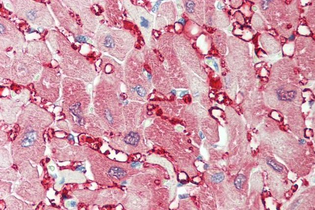 creatine kinase M-type Antibody