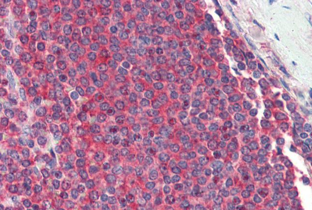 ribosomal protein L8 Antibody