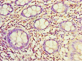 SDC1 Antibody