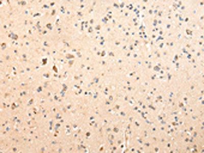 SDCBP Antibody