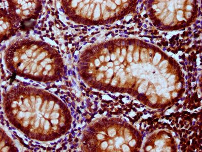 SEC23B Antibody