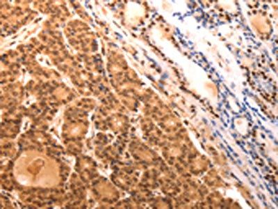SERPINC1 Antibody