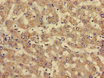 SERPINC1 Antibody