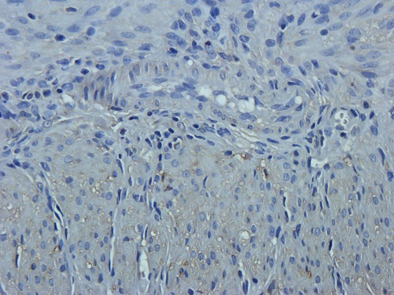 SERPING1 Rabbit Polyclonal Antibody