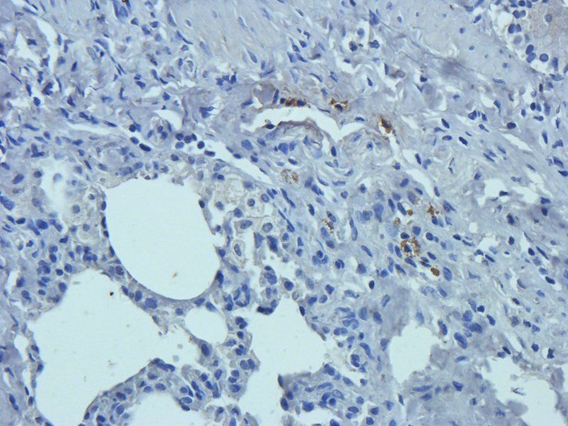 SERPING1 Rabbit Polyclonal Antibody