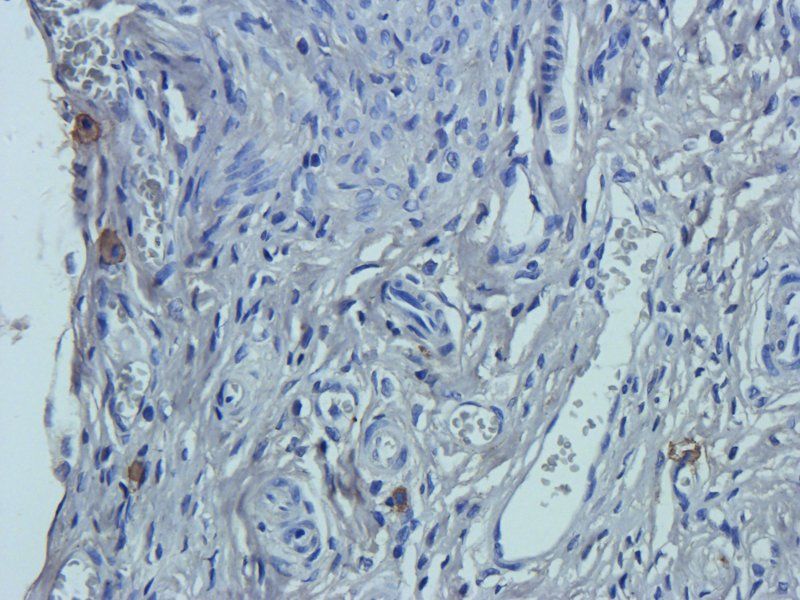 SERPING1 Rabbit Polyclonal Antibody