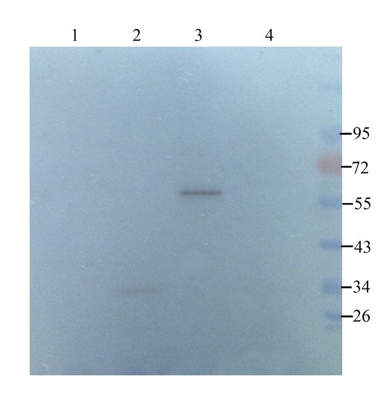 SERPING1 Rabbit Polyclonal Antibody