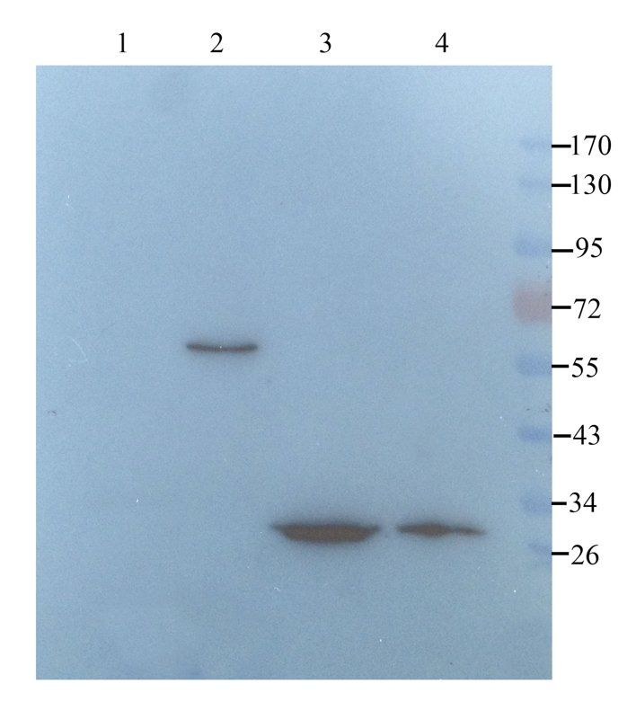 SERPING1 Rabbit Polyclonal Antibody