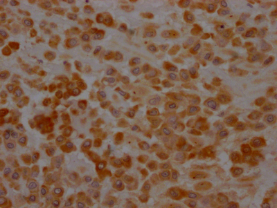 SERPINH1 Antibody