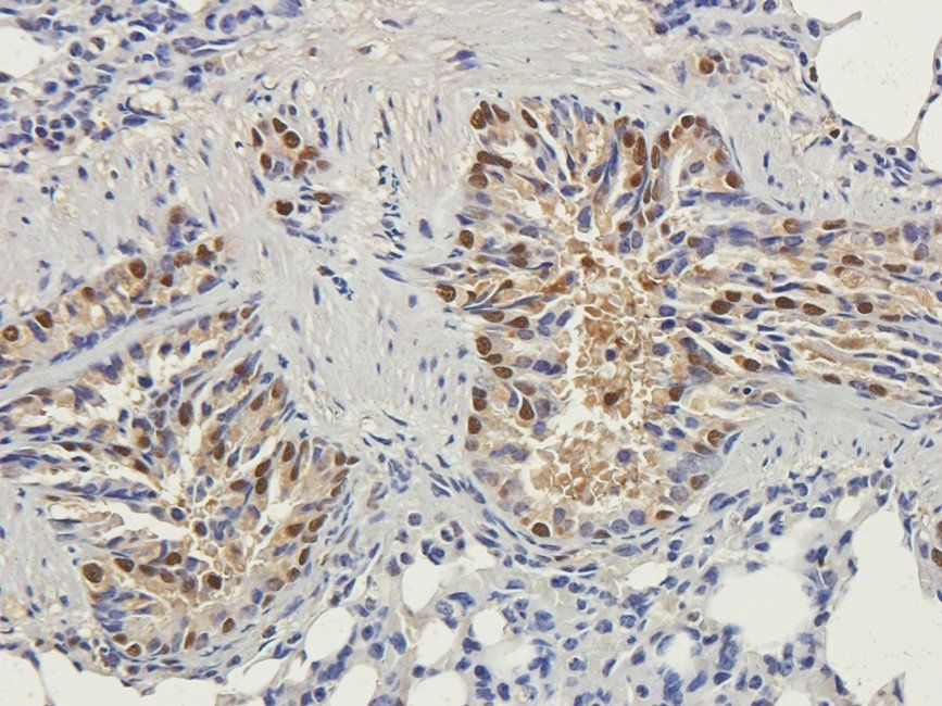 SET Rabbit Polyclonal Antibody