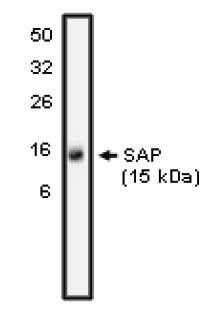 Rabbit Human SH21A (SH2 DOMAIN-CONTAINING PROTEIN 1A) / (SAP) Antibody
