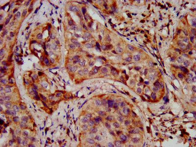 SHANK2 Antibody